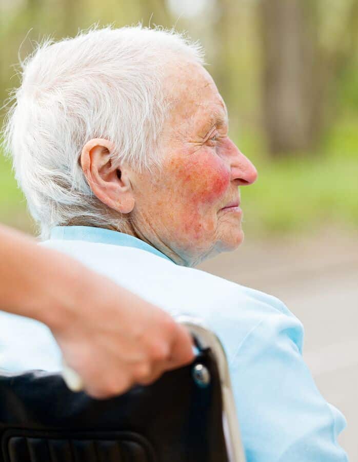 Elderly Care in Coronado CA: What Is Rosacea?