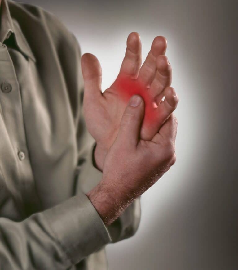  Rheumatoid Arthritis (RA)