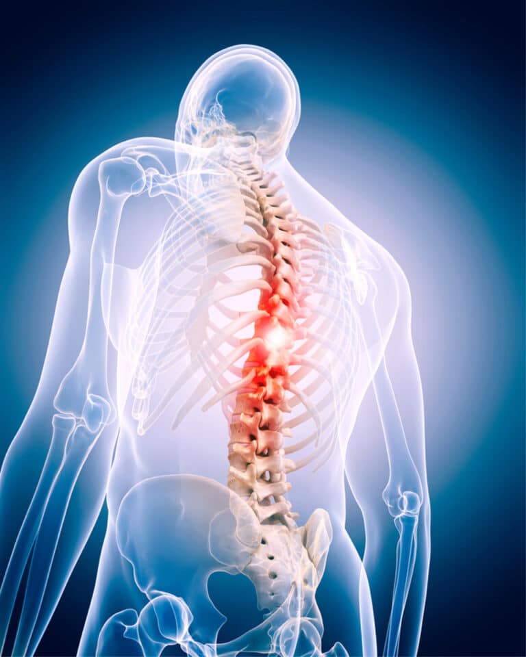 Home Care in San Diego CA: Spine Conditions